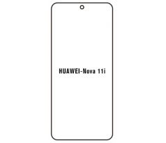 Hydrogel - ochranná fólie - Huawei Nova 11i (case friendly) 