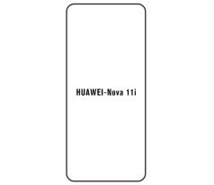 Hydrogel - ochranná fólie - Huawei Nova 11i