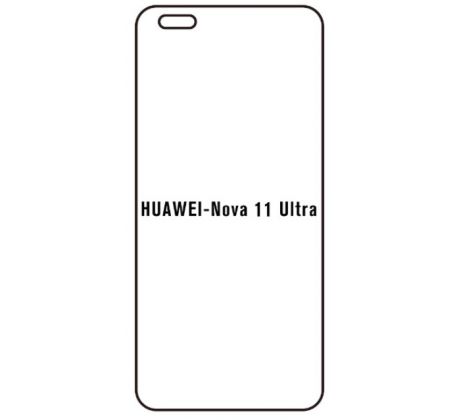 UV Hydrogel s UV lampou - ochranná fólie - Huawei Nova 11 Ultra