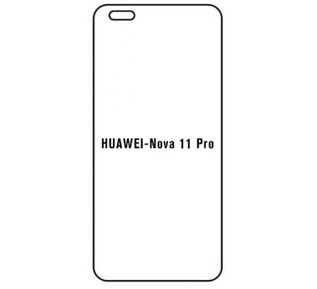Hydrogel - ochranná fólie - Huawei Nova 11 Pro (case friendly)  