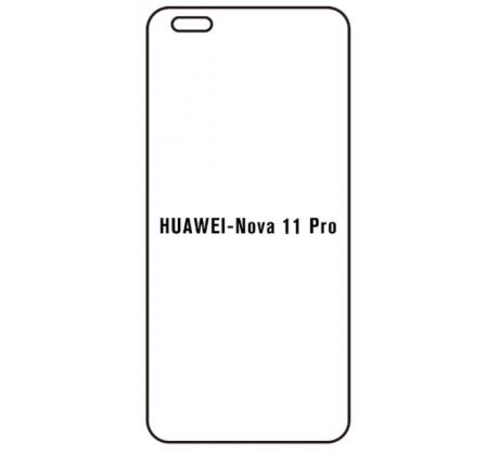 Hydrogel - Privacy Anti-Spy ochranná fólie - Huawei Nova 11 Pro