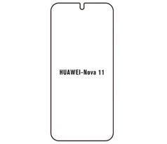 Hydrogel - ochranná fólie - Huawei Nova 11 (case friendly)  