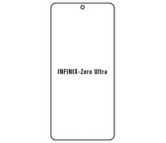 Hydrogel - ochranná fólie - Infinix Zero Ultra