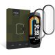 2KS V BALENÍ, SET 2 HYBRIDNÍCH SKEL HOFI HYBRID PRO+ 2-PACK XIAOMI SMART BAND 8 / 8 NFC BLACK