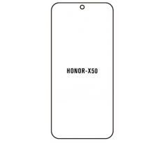 Hydrogel - ochranná fólie - Huawei Honor X50 (case friendly) 