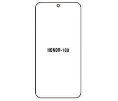 Hydrogel - ochranná fólie - Huawei Honor 100 (case friendly) 