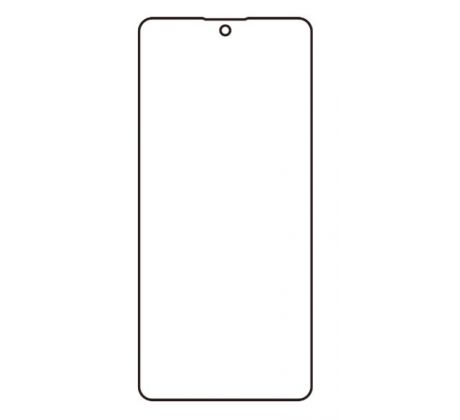 Hydrogel - ochranná fólie - Xiaomi Poco X6 (case friendly)   