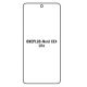 Hydrogel - ochranná fólie - OnePlus Nord CE4 Lite 5G (case friendly) 